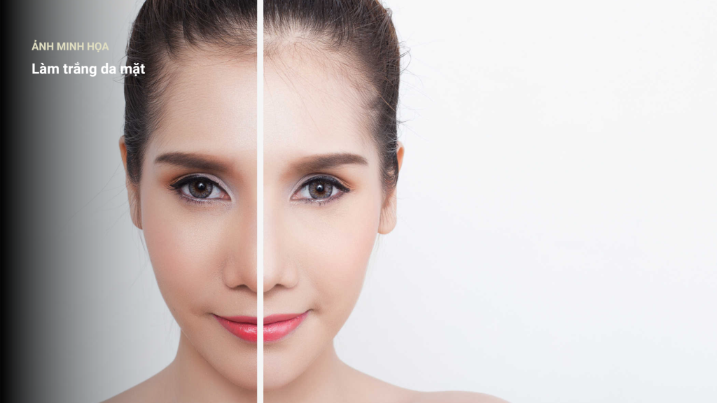 Spa làm trắng da mặt